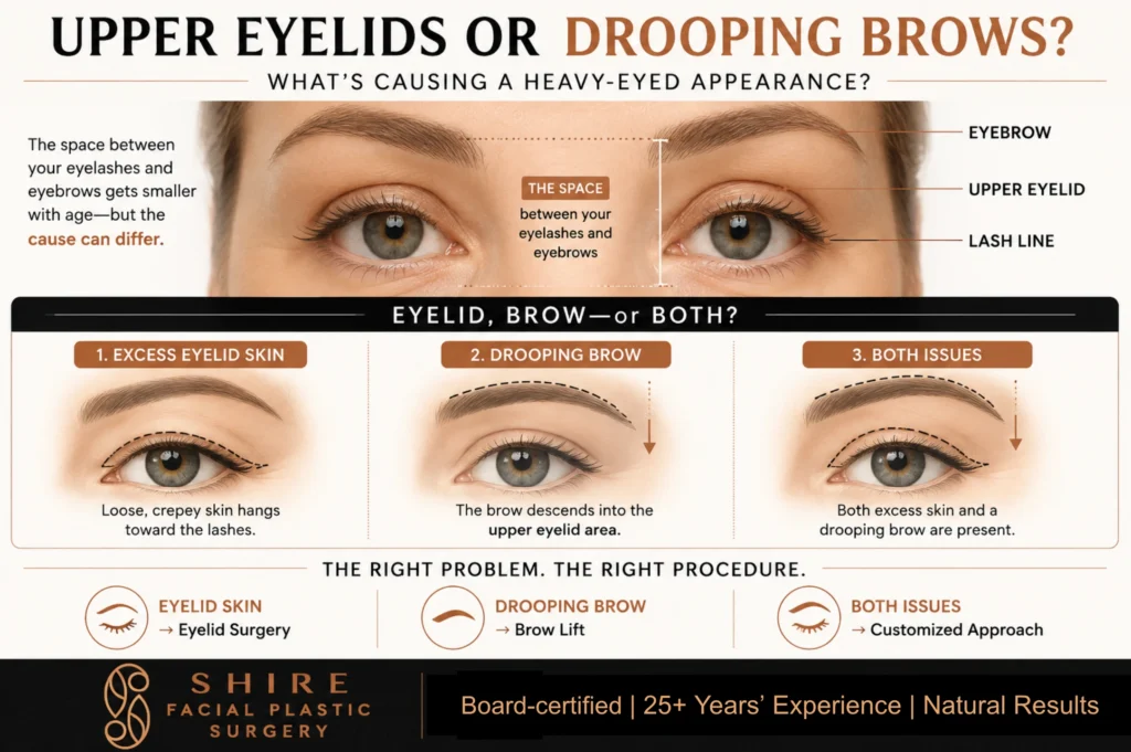 upper blepharoplasty versus brow lift infographic
